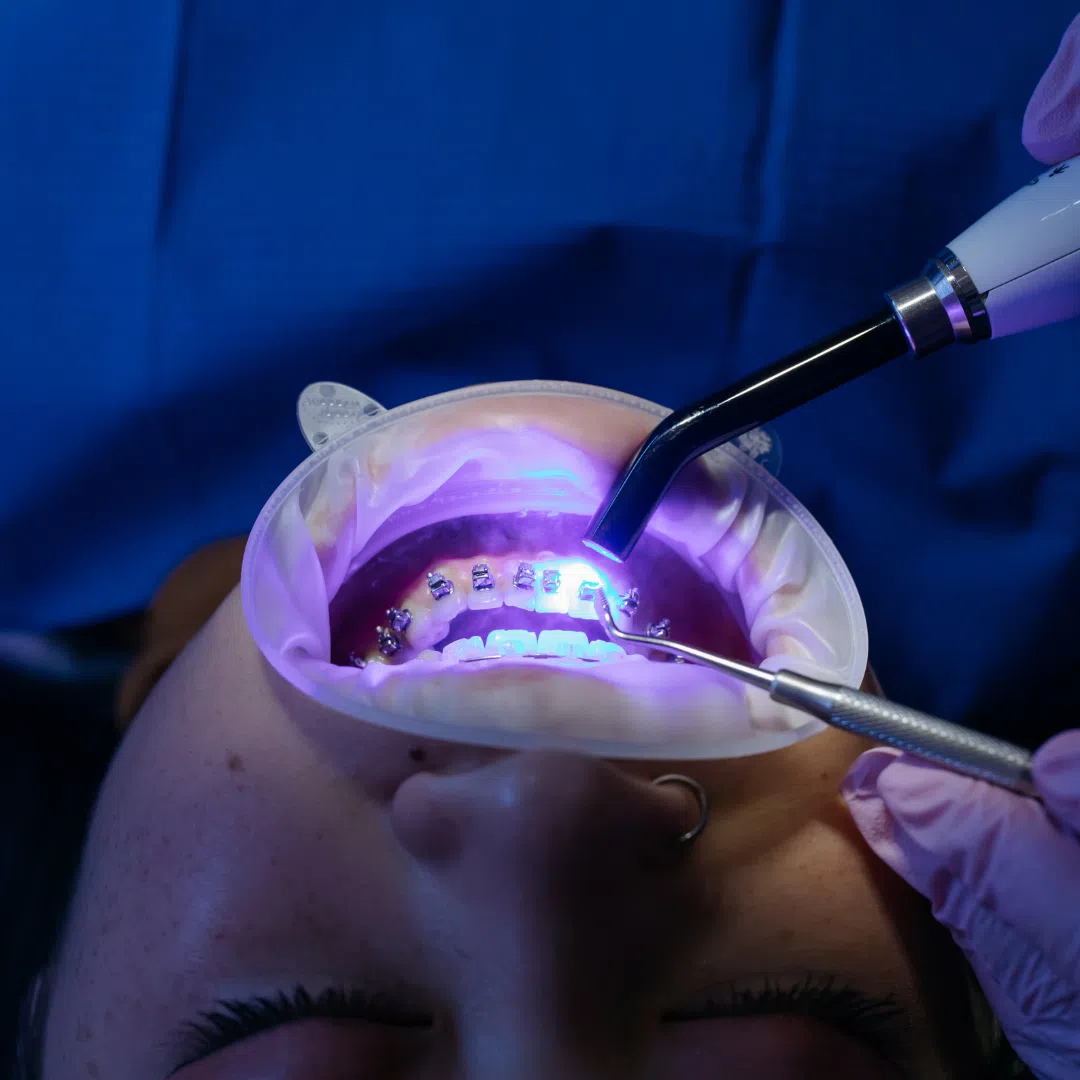 Blanqueamiento Dental Martin Hiroshi Odontólogo 00 » Marketplace Colombia