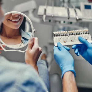 Diseño de Sonrisa Laminados Cerámicos