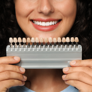 Diseño De Sonrisa En Resina De Alta Estética Camila Novoa 02 2 » Marketplace Colombia