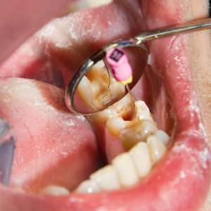 Endodoncia Camila Novoa 02 » Marketplace Colombia