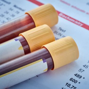 Exámenes Toma De Muestras Laboratorio Domicilio Bogotá 02