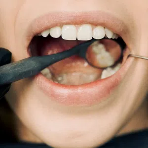 Rehabilitación Oral