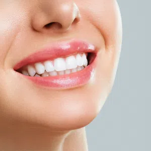 Colombia Marketplace Resinas Esteticas Martin Hiroshi Odontologo