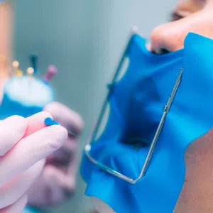 Tratamiento de Conducto Unirradicular