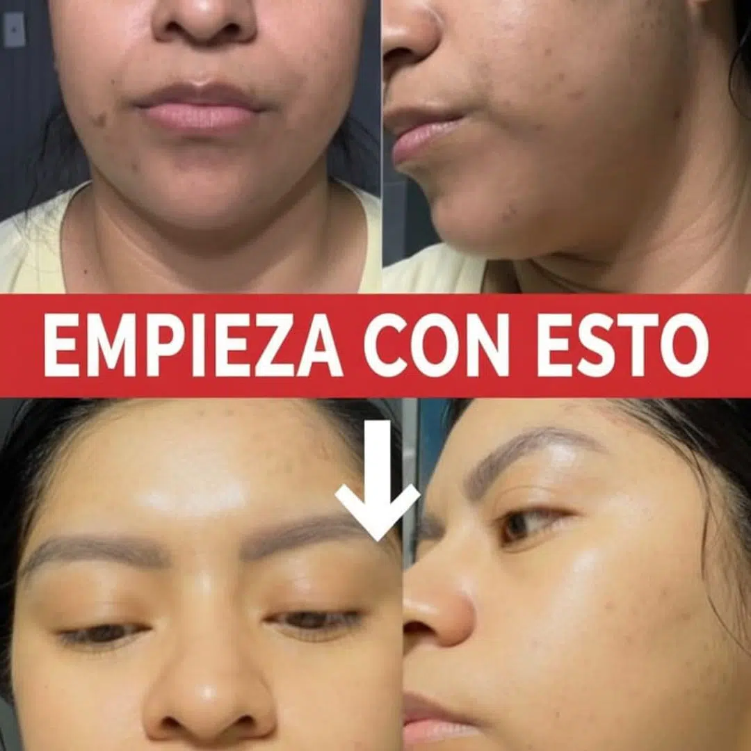 Colombia Marketplace Tea Tree Limpiador Facial Farmasi 03 » Marketplace Colombia Colombia Marketplace Tea Tree Limpiador Facial Farmasi 03